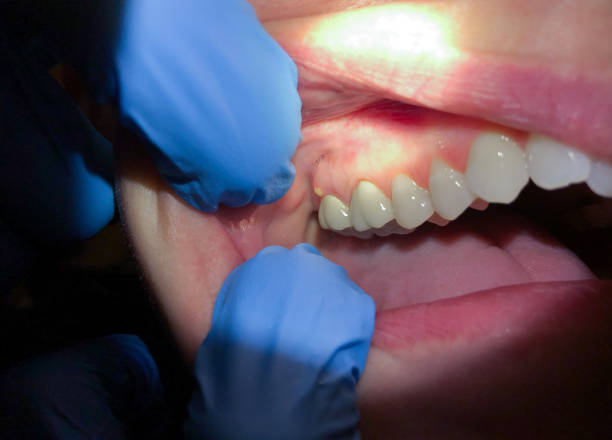 Best After-Hours Emergency Dentist in Valenti, NE
