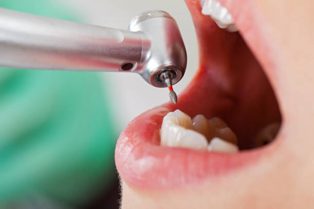 Best Weekend Emergency Dentist in Valenti, NE